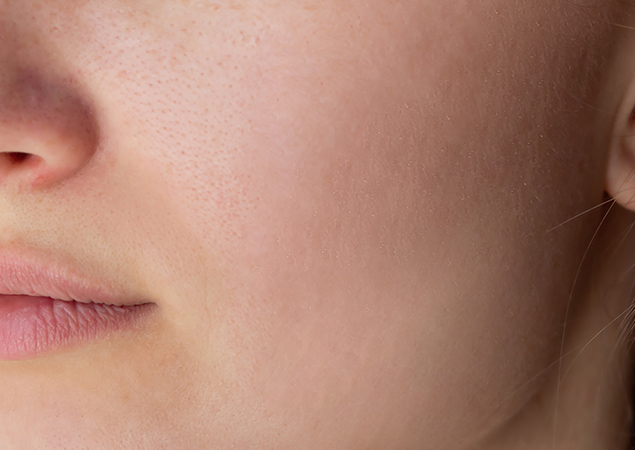 Clear skin result after dermatology treatment